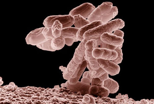 Vi-khuan-E.coli.jpg