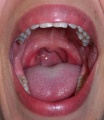 Mouth new bacterial species.jpg